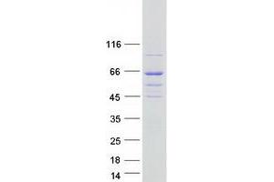 DENN/MADD Domain Containing 6B (DENND6B) protein (Myc-DYKDDDDK Tag)
