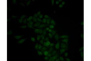 Immunofluorescence analysis of MCF-7 cells using CTSE antibody. (Cathepsin E 抗体)