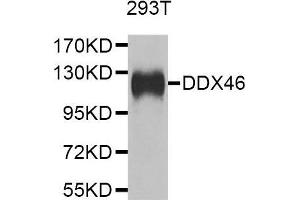 Western blot analysis of extracts of 293T cell line, using DDX46 antibody. (DDX46 抗体  (AA 682-1031))