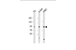 All lanes : Anti-NUP93 Antibody (N-Term) at 1:2000 dilution Lane 1: F9 whole cell lysate Lane 2: Jurkat whole cell lysate Lane 3: K562 whole cell lysate Lysates/proteins at 20 μg per lane. (NUP93 抗体  (AA 20-54))