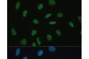 Immunofluorescence analysis of U-2 OS cells using MKL1 Polyclonal Antibody at dilution of 1:100 (40x lens). (MKL1 抗体)