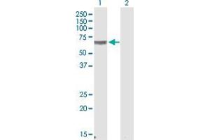 Western Blot analysis of CRAT expression in transfected 293T cell line by CRAT polyclonal antibody (A01). (CRAT 抗体  (AA 445-544))