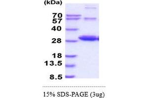 SDS-PAGE (SDS) image for Ras-related Protein Ral-A (rala) (AA 1-203) protein (His tag) (ABIN5855037) (rala Protein (AA 1-203) (His tag))