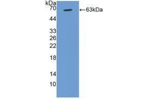 Western blot analysis of recombinant Human CCND1.
