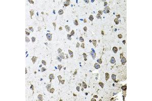 Immunohistochemistry of paraffin-embedded mouse brain using FGF1 antibody at dilution of 1:100 (x40 lens). (FGF1 抗体)