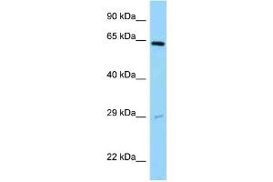 WB Suggested Anti-SNX11 Antibody Titration: 1. (SNX11 抗体  (Middle Region))