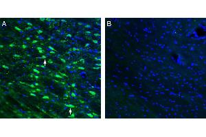 Expression of ACE2 in mouse thalamus.