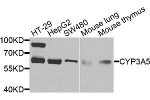 Western blot analysis of extracts of various cells, using CYP3A5 antibody. (CYP3A5 抗体)