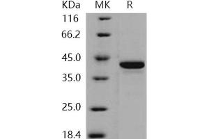 Western Blotting (WB) image for Serine/threonine Kinase 10 (STK10-A) (Active) protein (His tag) (ABIN7317065) (STK10-A Protein (His tag))
