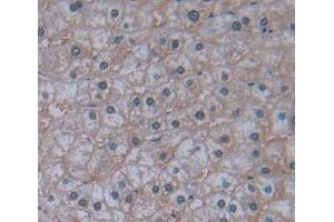IHC-P analysis of liver tissue, with DAB staining. (IRS4 抗体  (AA 1-196))