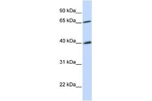WB Suggested Anti-CHEK2 Antibody Titration:  0. (CHEK2 抗体  (N-Term))