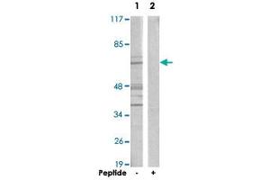 Western blot analysis of extracts from A-549 cells, using CERKL polyclonal antibody . (CERKL 抗体)