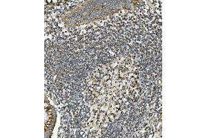 IHC analysis of SGK1 using anti-SGK1 antibody (ABIN7603118).