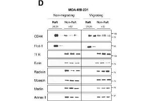 Western Blotting (WB) image for anti-Radixin (RDX) antibody (ABIN2856100)