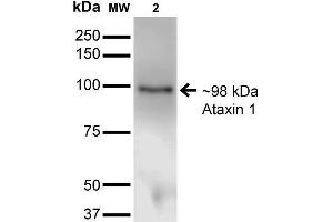 Western Blot analysis of Monkey COS-1 cells transfected with Ataxin- 1 showing detection of ~85 kDa Ataxin 1 protein using Mouse Anti-Ataxin 1 Monoclonal Antibody, Clone S65-37 . (Ataxin 1 抗体  (AA 746-761) (PerCP))