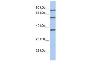Western Blot showing RPH3A antibody used at a concentration of 1-2 ug/ml to detect its target protein. (RPH3A 抗体  (N-Term))