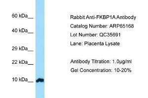 Western Blotting (WB) image for anti-FK506 Binding Protein 1A, 12kDa (FKBP1A) (N-Term) antibody (ABIN2790065) (FKBP1A 抗体  (N-Term))