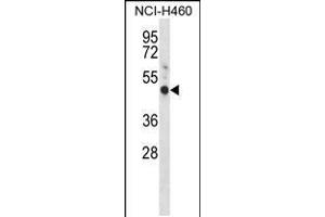 Western blot analysis in NCI-H460 cell line lysates (35ug/lane). (GYPE 抗体  (C-Term))