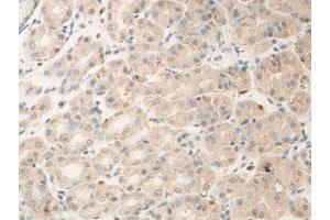 Immunohistochemical staining of formalin-fixed paraffin-embedded human stomach showing membrane staining with ADAM15 polyclonal antibody  at 1:100 dilution. (ADAM15 抗体)