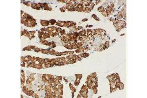 Immunohistochemistry (IHC) image for anti-NADH Dehydrogenase (Ubiquinone) 1 alpha Subcomplex, 1, 7.5kDa (NDUFA1) (AA 54-70), (C-Term) antibody (ABIN3044247)
