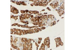 Anti-NDUFA1 antibody, IHC(P) IHC(P): Rat Cardiac Muscle Tissue (NDUFA1 抗体  (C-Term))