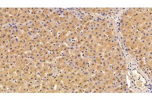 Immunohistochemistry (IHC) image for anti-Serpin Family A Member 7 (SERPINA7) (AA 128-415) antibody (ABIN7429163)
