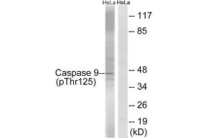 Western blot analysis of extracts from HeLa cells, treated with TNF (20ng/ml, 5mins) and calyculinA (50ng/ml, 15mins), using Caspase 9 (Phospho-Thr125) antibody. (Caspase 9 抗体  (pThr125))