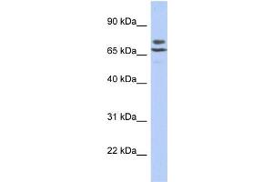 Human SH-SYSY; WB Suggested Anti-C3orf39 Antibody Titration: 0. (C3orf39 抗体  (N-Term))