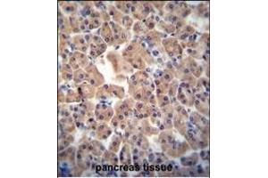 ATPBD3 antibody (Center) (ABIN654307 and ABIN2844091) immunohistochemistry analysis in formalin fixed and paraffin embedded human pancreas tissue followed by peroxidase conjugation of the secondary antibody and DAB staining. (ATPBD3 抗体  (AA 208-236))