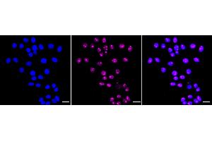 anti-PHD Finger Protein 8 (PHF8) antibody