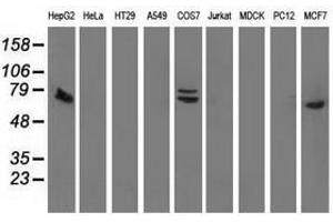 Image no. 3 for anti-SAM Domain and HD Domain 1 (SAMHD1) antibody (ABIN1500800) (SAMHD1 抗体)