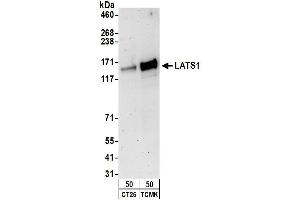 Western Blotting (WB) image for anti-LATS, Large Tumor Suppressor, Homolog 1 (Drosophila) (LATS1) (AA 50-100) antibody (ABIN7452207)