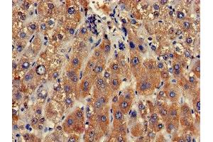 Immunohistochemistry of paraffin-embedded human liver tissue using ABIN7147821 at dilution of 1:100 (Clarin 2 抗体  (AA 31-100))