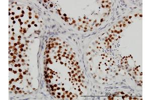 Immunostaining (ISt) image for anti-Cleavage Stimulation Factor, 3' Pre-RNA, Subunit 3, 77kDa (CSTF3) (AA 1-103) antibody (ABIN560513)