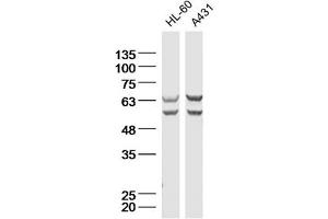Lane 1: HL-60 Cell lysates; Lane 2: A431 Cell lysates; probed with Natriuretic Peptide Receptor C Polyclonal Antibody, unconjugated (bs-2333R) at 1:300 overnight at 4°C followed by a conjugated secondary antibody for 60 minutes at 37°C. (NPR3 抗体  (AA 301-400))