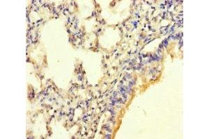 Immunohistochemistry of paraffin-embedded human lung tissue using ABIN7165887 at dilution of 1:100 (SGK196 抗体  (AA 44-350))