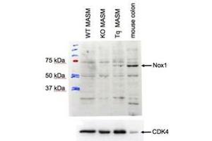 Western Blotting (WB) image for anti-NADPH Oxidase 1 (NOX1) (Internal Region) antibody (ABIN2464425) (NOX1 抗体  (Internal Region))