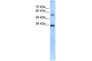 WB Suggested Anti-CA8 Antibody Titration:  5. (CA8 抗体  (N-Term))