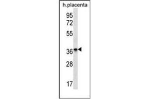 Western Blotting (WB) image for anti-Olfactory Receptor, Family 8, Subfamily D, Member 4 (OR8D4) (AA 279-308), (C-Term) antibody (ABIN953895)