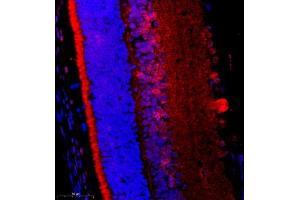 Immunofluorescence of paraffin embedded rat eye using FGF11 (ABIN7073941) at dilution of 1:2200 (400x lens) (FGF11 抗体)