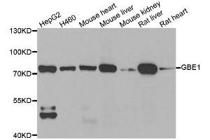 Western blot analysis of extracts of various cell lines, using GBE1 antibody. (GBE1 抗体  (AA 1-300))
