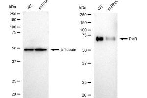 anti-Poliovirus Receptor (PVR) antibody