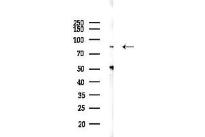 Western blot analysis of lysates from HUVEC cells(LPS 4h treatment), using S Antibody at 1/1000 dilution.