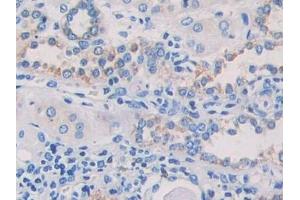 Immunohistochemistry (IHC) image for anti-Microtubule-Associated Protein, RP/EB Family, Member 1 (MAPRE1) (AA 2-268) antibody (ABIN7436300)