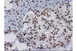 Image no. 2 for anti-CTD (Carboxy-terminal Domain, RNA Polymerase II, Polypeptide A) Small Phosphatase 1 (CTDSP1) antibody (ABIN1497679) (CTDSP1 抗体)