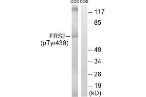 Western blot analysis of extracts from COS cells, using FRS2 (Phospho-Tyr436) antibody. (FRS2 抗体  (pTyr436))