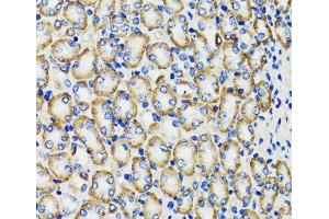 Immunohistochemistry of paraffin-embedded Rat kidney using COMT Polyclonal Antibody at dilution of 1:100 (40x lens). (COMT 抗体)