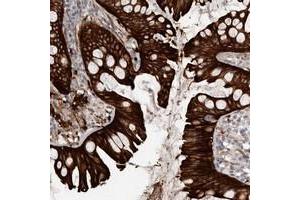 Immunohistochemical staining of human colon with CGN polyclonal antibody  shows strong cytoplasmic and membranous positivity in glandular cells at 1:50-1:200 dilution. (Cingulin 抗体)