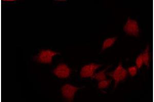 ABIN6267633 staining 293 by IF/ICC. (PAK1 抗体  (pThr212))