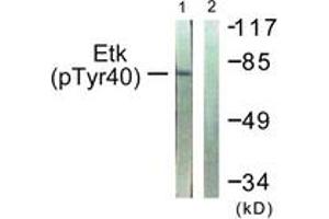 Western blot analysis of extracts from HepG2 cells, using ETK (Phospho-Tyr40) Antibody. (BMX 抗体  (pTyr40))